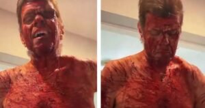 Celebrity Blogger Perez Hilton Still Hospitalized After Cutting Himself on TikTok Live, Will Need Surgery * The Gateway Pundit * by Cristina Laila