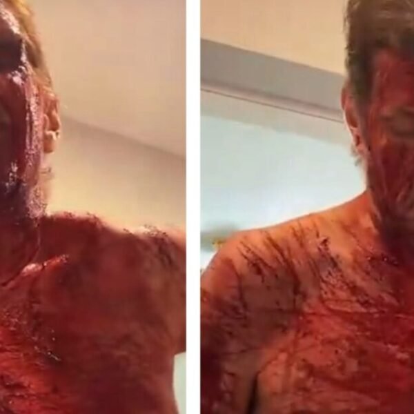 Celebrity Blogger Perez Hilton Still Hospitalized After Cutting Himself on TikTok Live,…