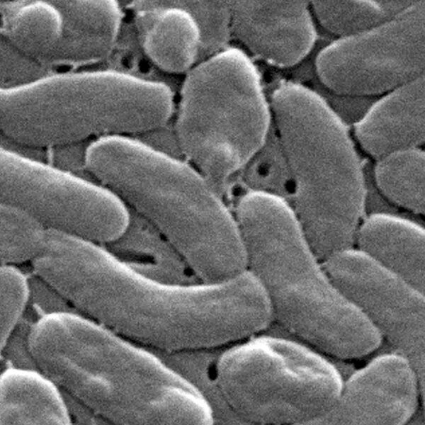 Flesh-eating micro organism infections surge alongside the Gulf Coast with 5 deaths…