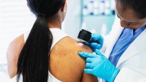 Cancer vaccine stops melanoma from returning or spreading in historic trial
