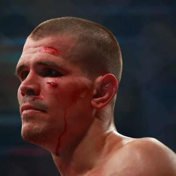UFC Vegas 121 Betting Splits: Where the Sharp Money Is Landing This…