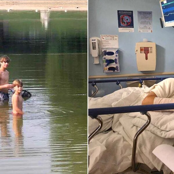 Maryland household speaks after rabid beaver assaults boy: ‘Completely unprovoked’