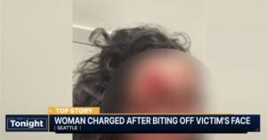 HORROR: ‘Zombie’ Attacker Bites Chunk of Woman’s Face Off in Seattle in Racially Motivated Attack * The Gateway Pundit * by Cristina Laila