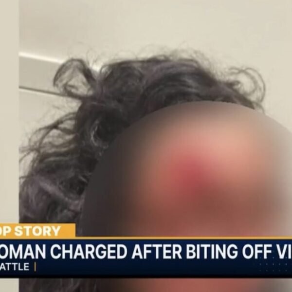 HORROR: ‘Zombie’ Attacker Bites Chunk of Woman’s Face Off in Seattle in&hellip;