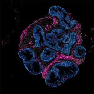 Intero Biosystems desires drugmakers to check on mini human intestines, not animals