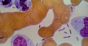 Possible Plague Crisis in Siberia: Five Hospitals Placed Under Quarantine After Lab Tech Dies Following Test Tube Accident Containing Plague Bacteria